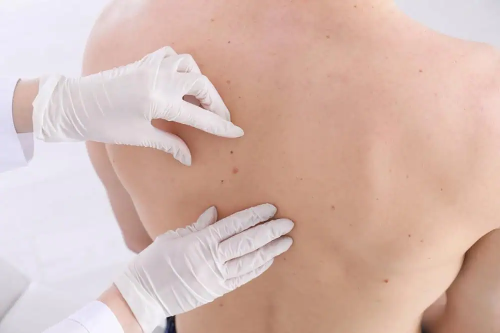 facet joint injections