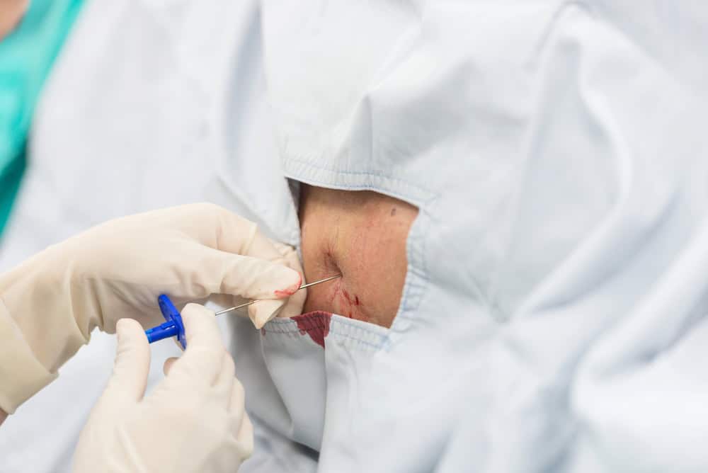 Selective Nerve Root Blocks: A Focused Approach for Pain Management Depositphotos 54391305 S