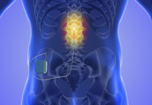 dorsal root ganglion