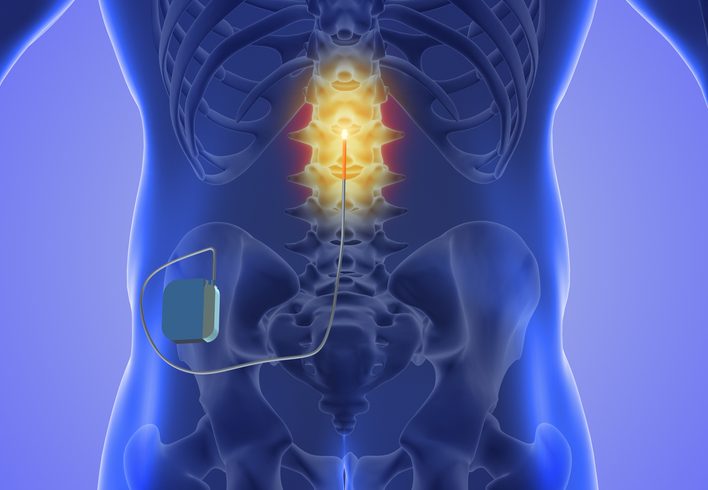 dorsal root ganglion