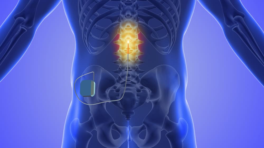 dorsal root ganglion