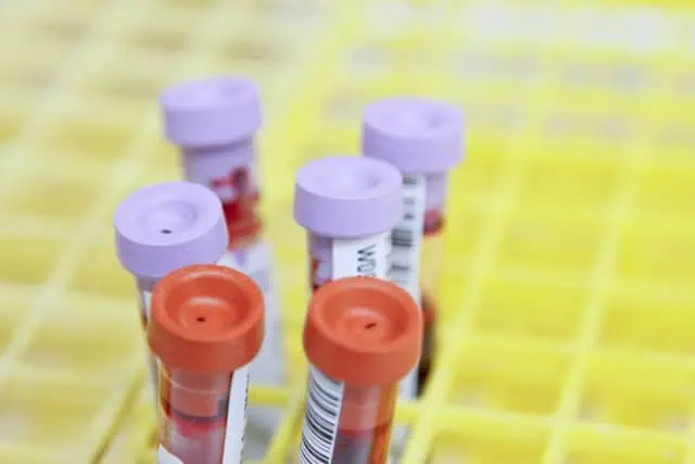 hormone blood test