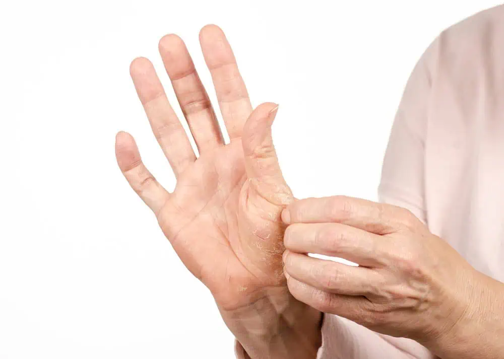 Finger Joint Pain