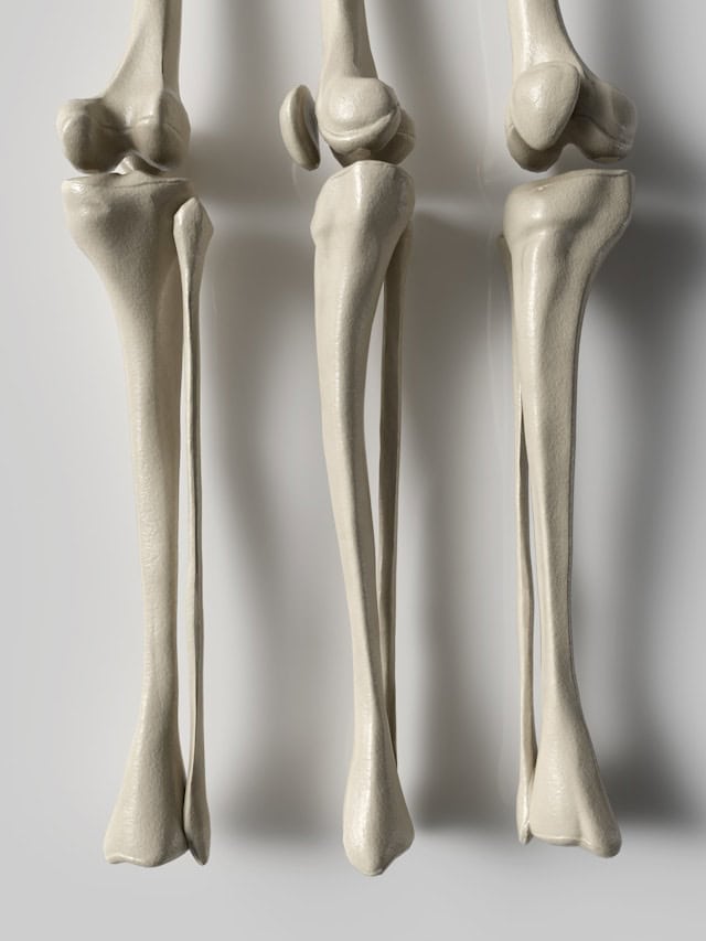 Menopause Joint Pain